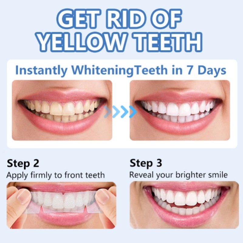 Teeth Whitening Strips 